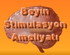 Beyin Ameliyatı